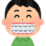 歯科矯正の進捗：次男(令和2年12月)